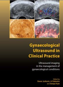 Book Cover: Gynaecological Ultrasound in Clinical Practice