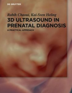 Book Cover: 3D Ultrasound of Prenatal Diagnosis